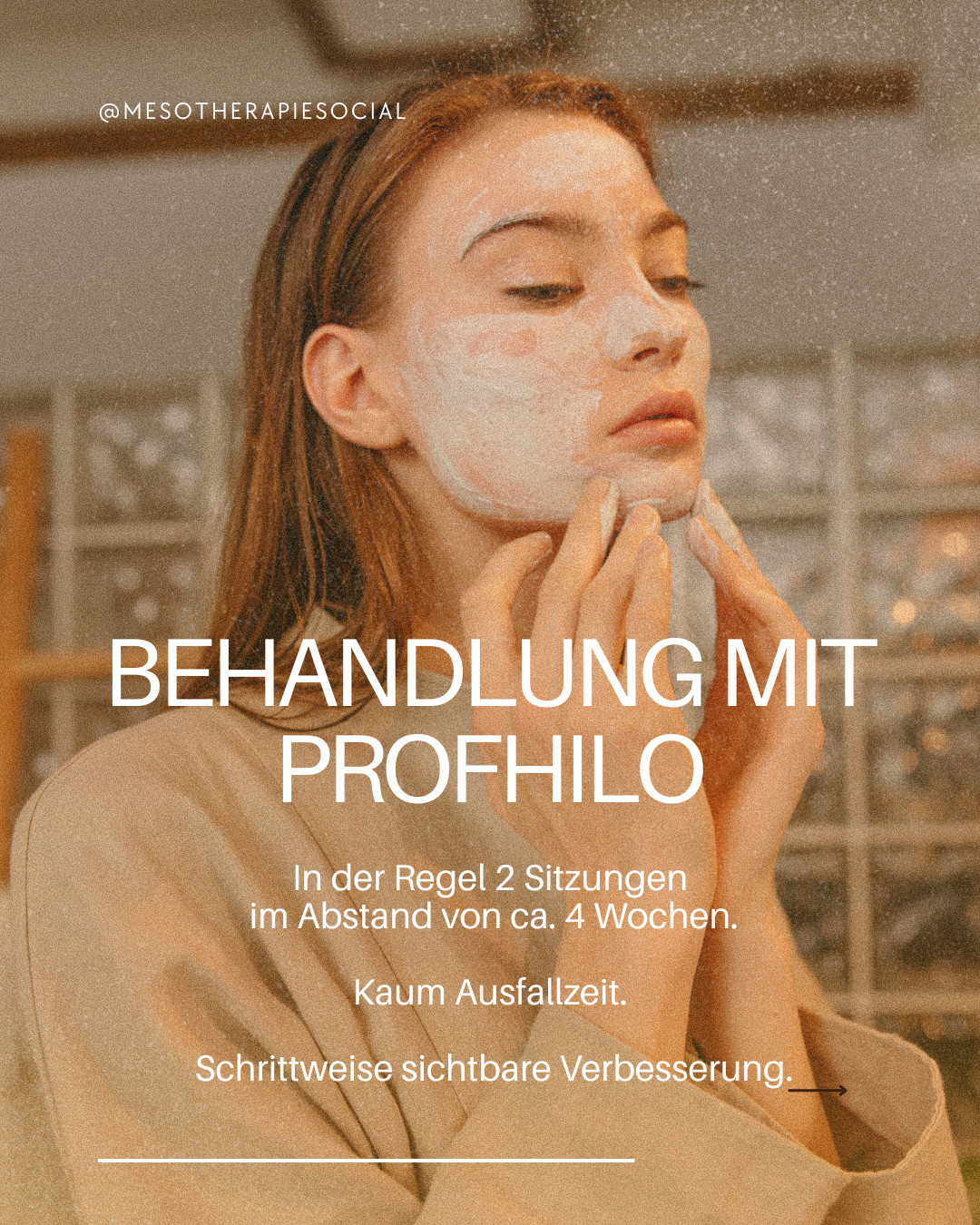 Behandlung mit Profhilo