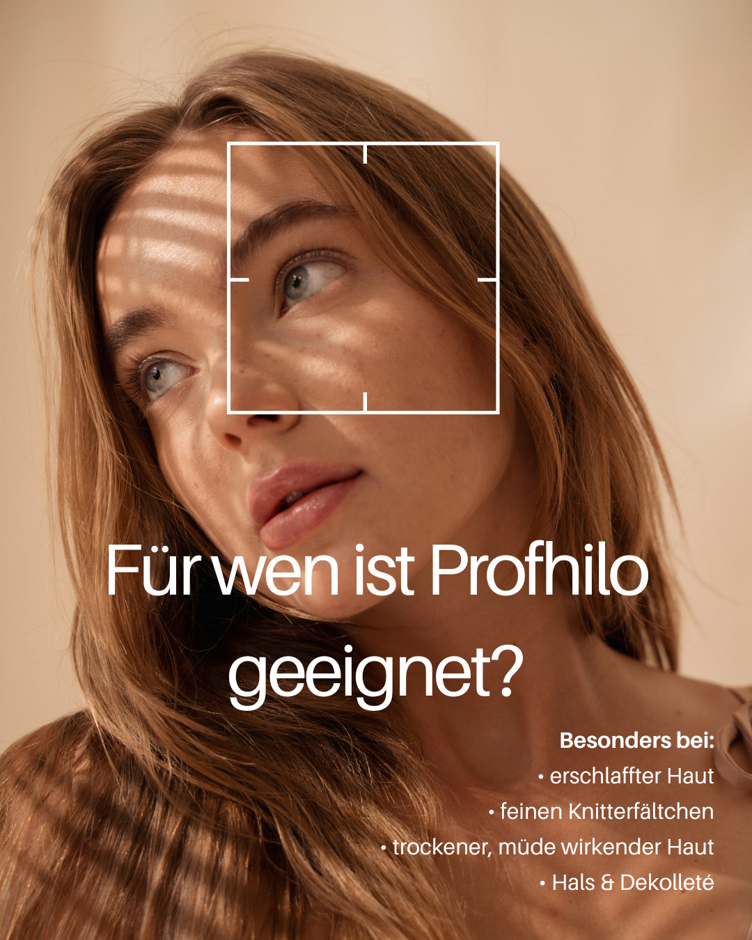Für wen ist Profhilo geeignet?