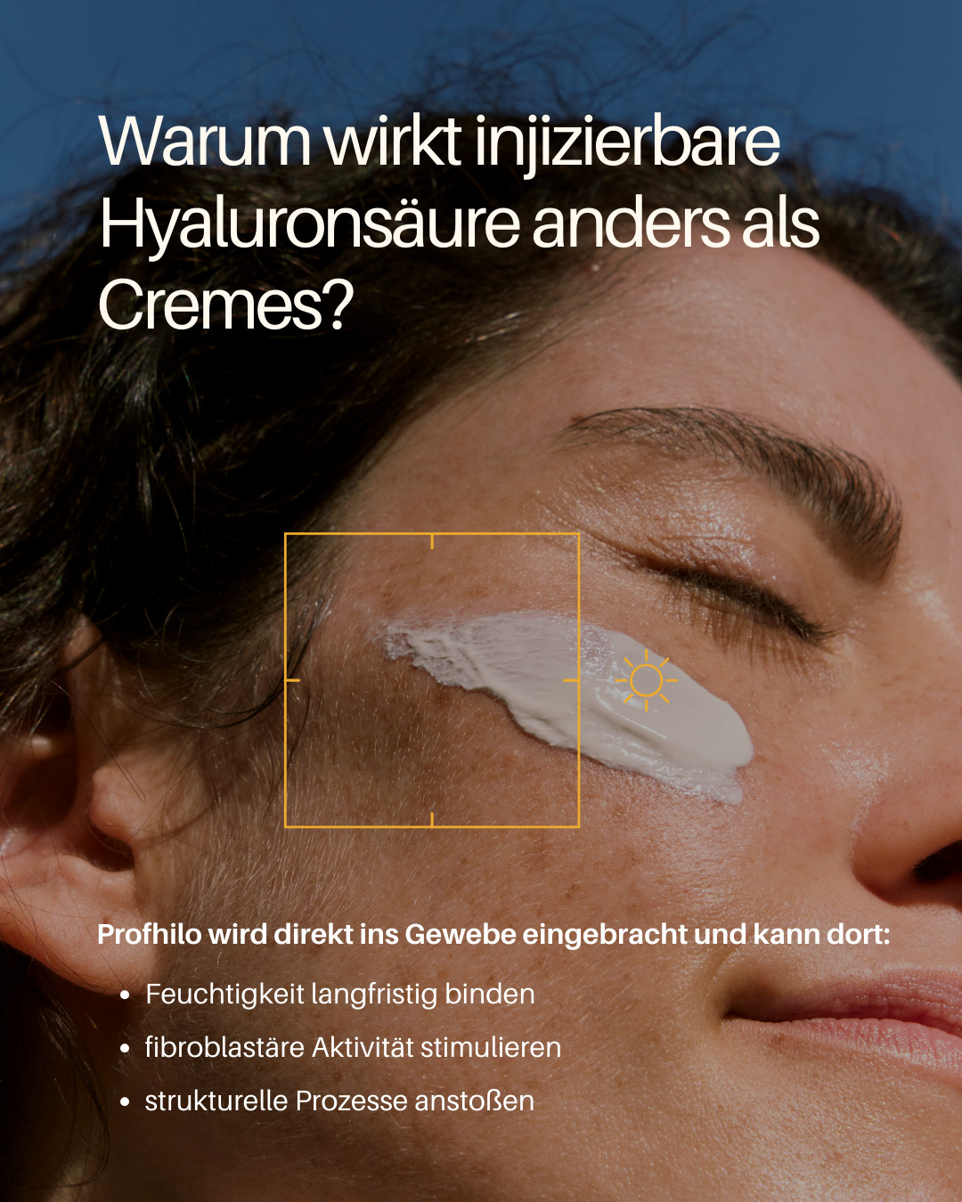 Warum wirkt injizierbare Hyaluronsäure anders als Cremes?